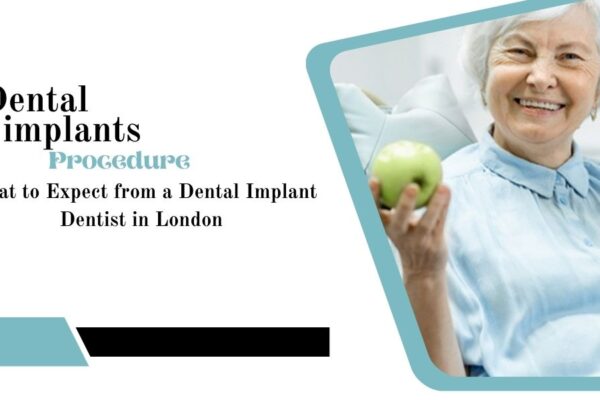 What to Expect from a Dental Implants Dentist in London