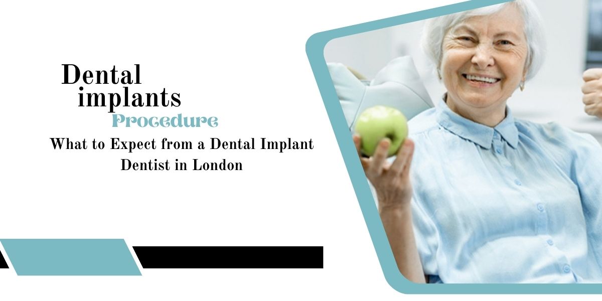 What to Expect from a Dental Implants Dentist in London
