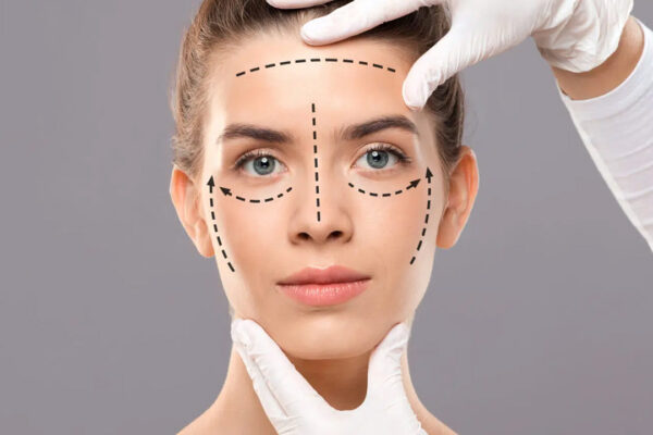 Facelift: Everything You Need to Know Before You Go