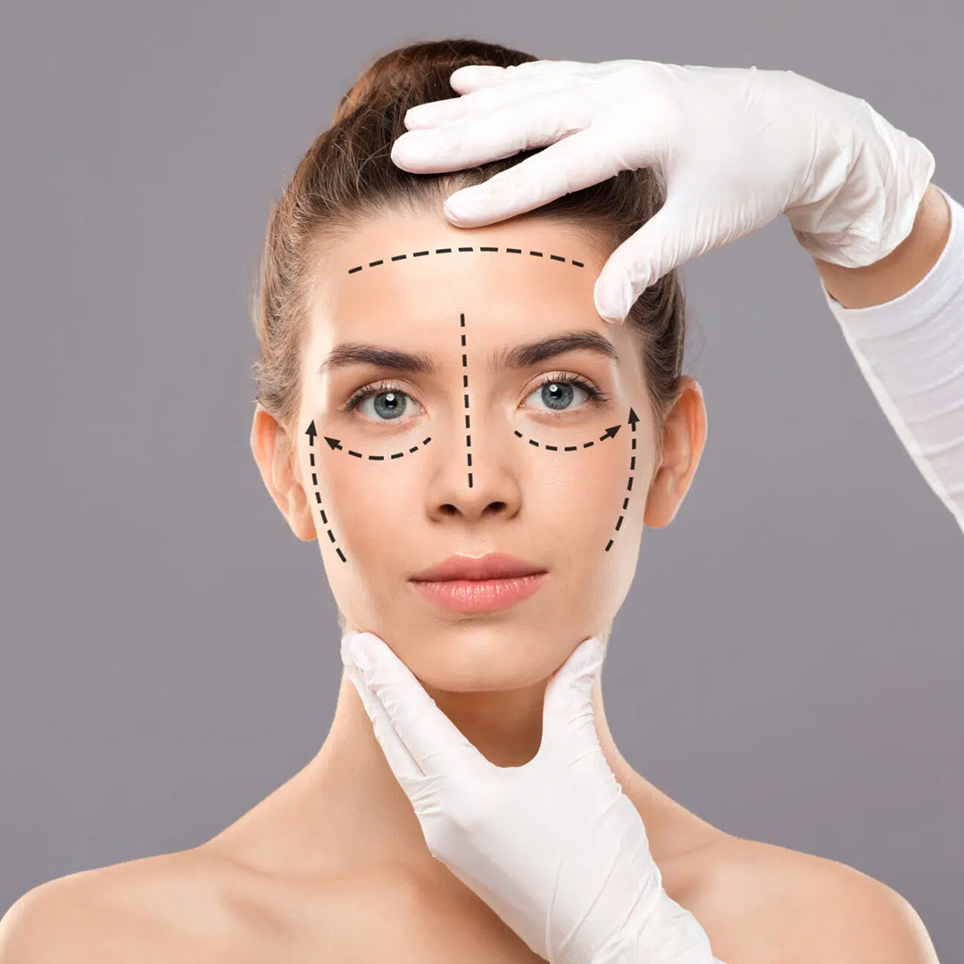 Facelift: Everything You Need to Know Before You Go