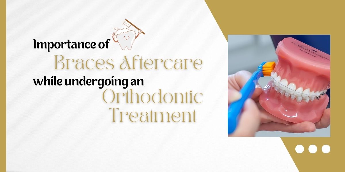 Importance of braces aftercare while undergoing an orthodontic treatment