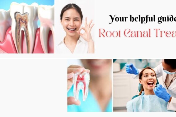 Your-helpful-guide-to-root-canal-treatment