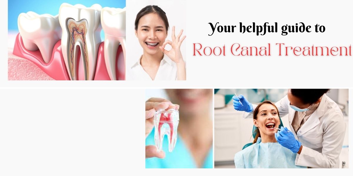 Your-helpful-guide-to-root-canal-treatment
