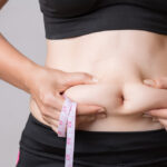 Liposuction in Dubai